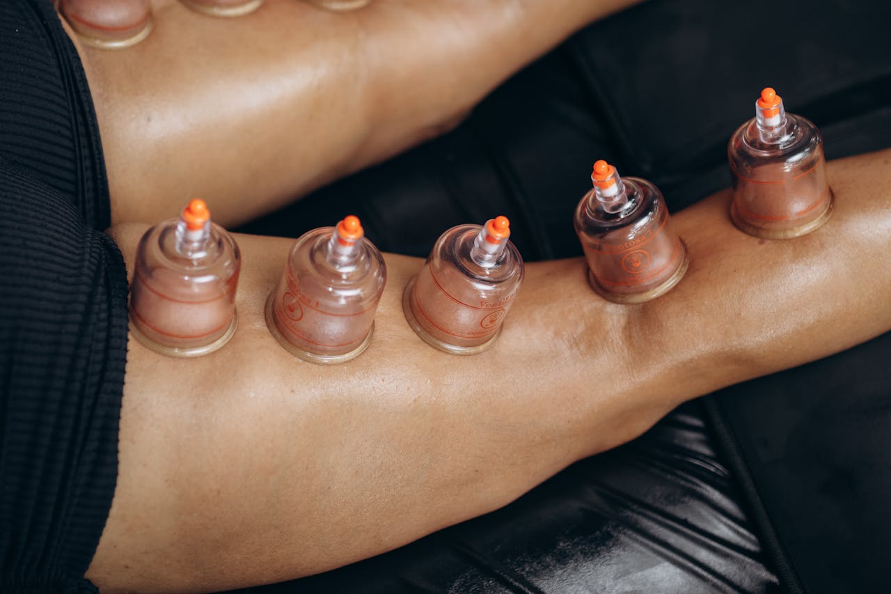 Sessão de massagem com ventosas na Savassi BH com atendimento profissional e ambiente confortável